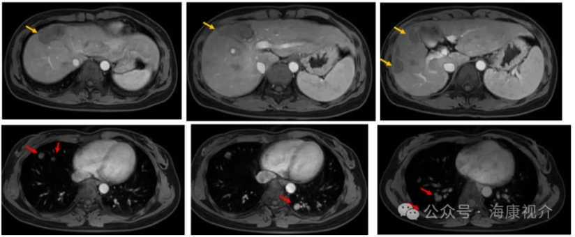 Preoperative_Imaging_01.jpg