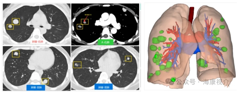 Preoperative_Imaging_03.png