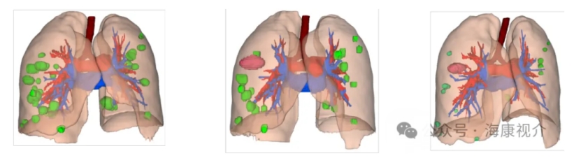 Preoperative_Imaging_07.png