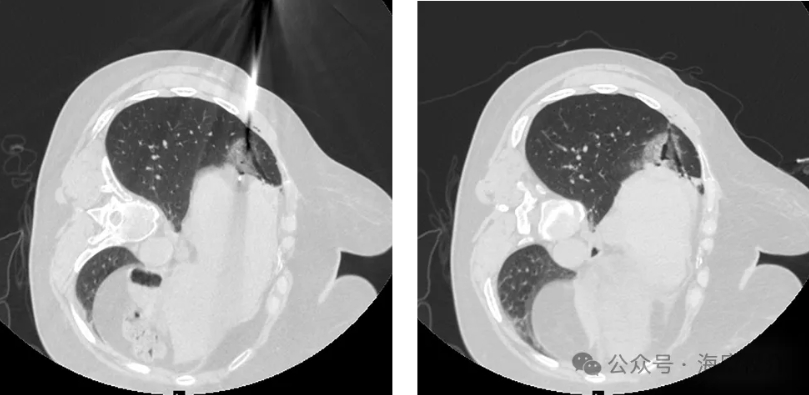 Preoperative_Imaging_Data_04.jpg