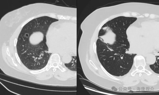 Preoperative_Imaging_Data_05.jpg